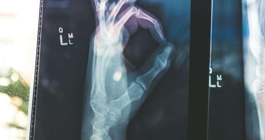 Prazo para o Plano de Saúde Autorizar Tratamento de Câncer: O Que Diz a ANS