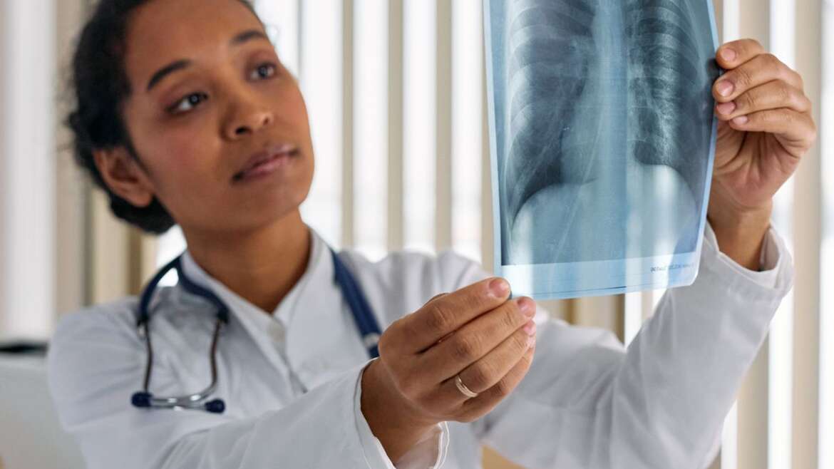 Médico analisa uma radiografia de tórax em ambiente clínico