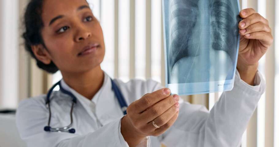 Médico analisa uma radiografia de tórax em ambiente clínico