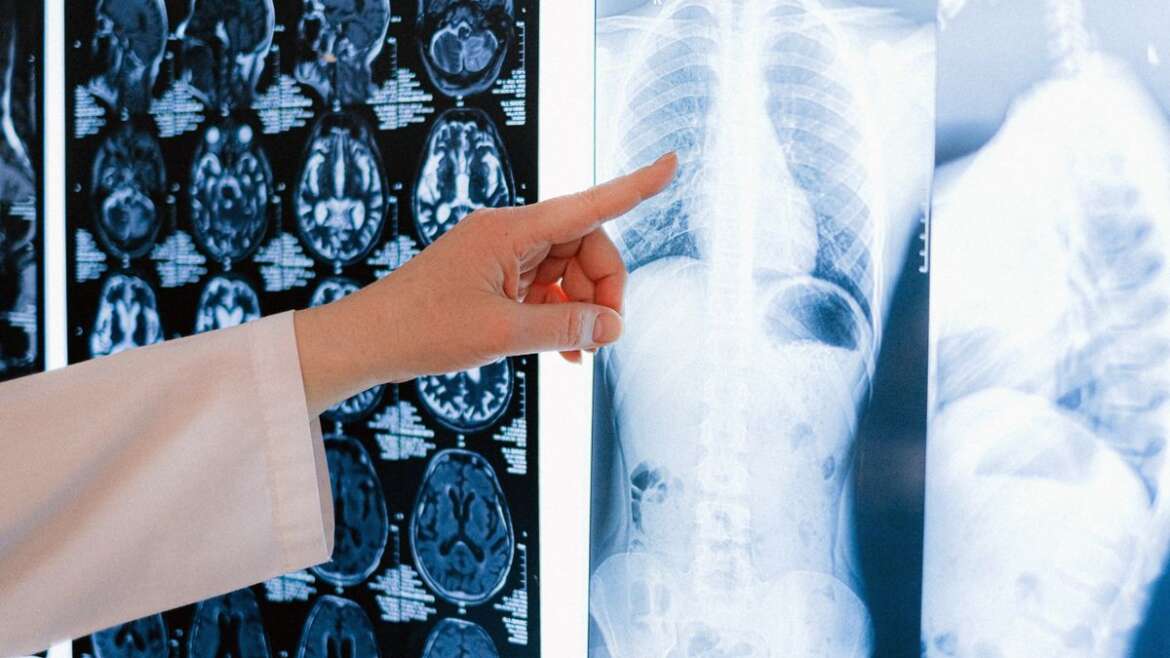 Médico analisa exames de imagem em ambiente clínico