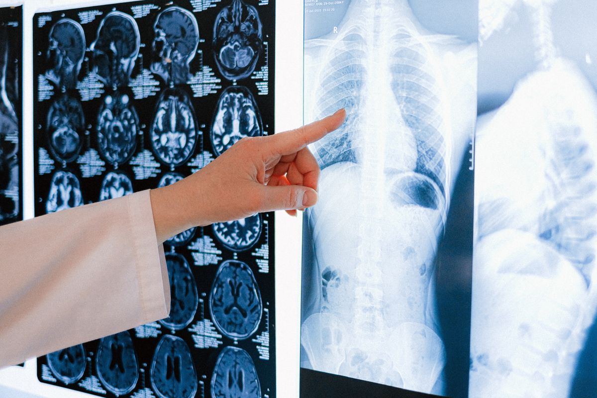 Médico analisa exames de imagem em ambiente clínico