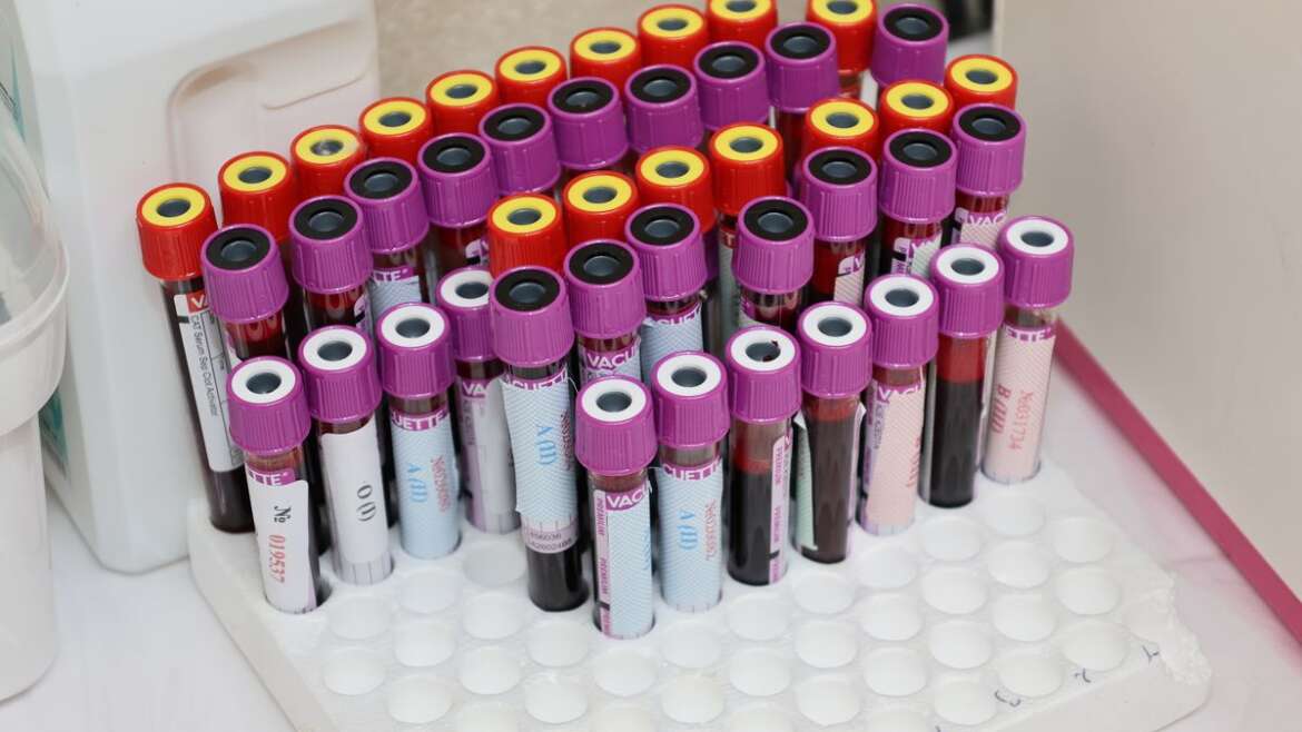 Tubos de amostras de sangue organizados em laboratório