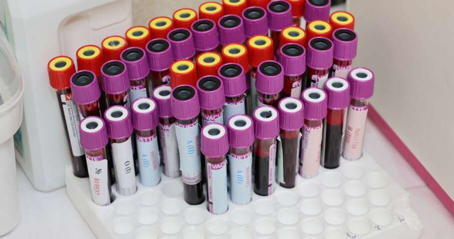 Tubos de amostras de sangue organizados em laboratório