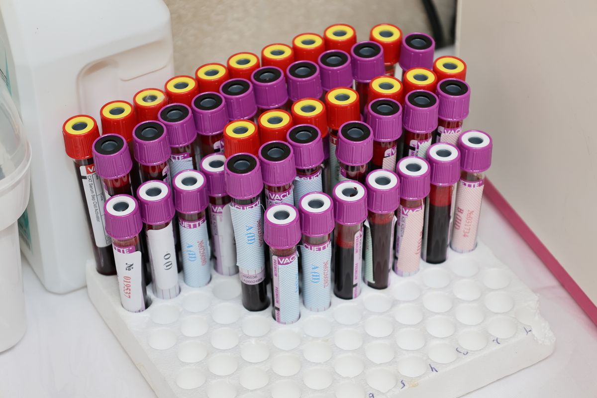 Tubos de amostras de sangue organizados em laboratório